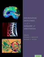 2013_Neurologic_Outcomes_of_Surgery.pdf