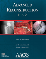 AAOSAdvancedReconstructionofhip.pdf