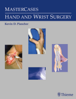 Hand_and_Wrist_Surgery.pdf