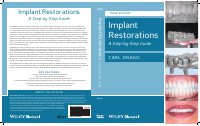 luzvg.Implant.Restorations.A.StepbyStep.Guide.3.edition.pdf