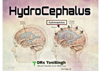 Hydrocephalus.pdf