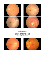 luis-enrique-manual-de-neuro-oftalmología-pdf-2005.pdf